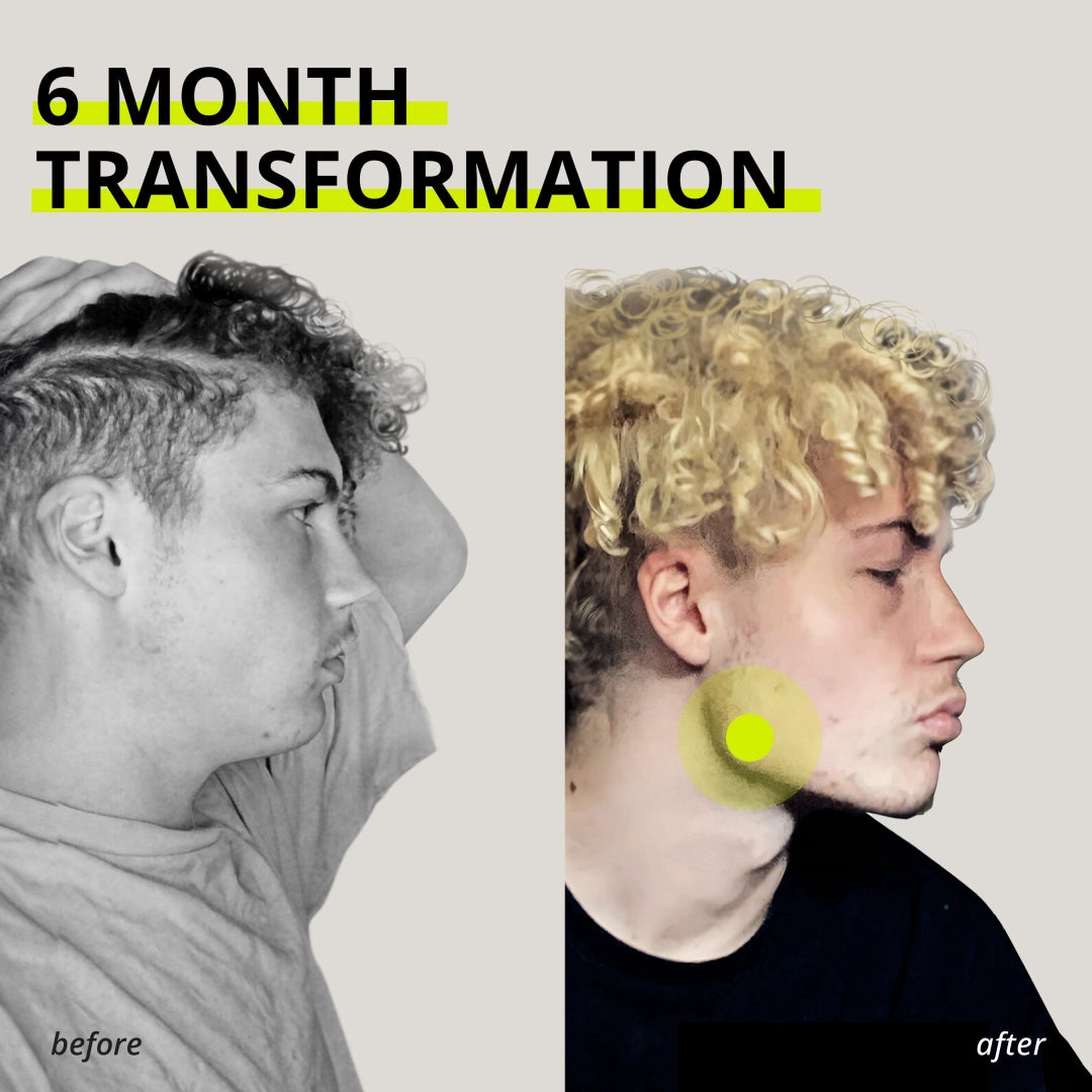 JAWLINER® 3.0 - Elite Edition - Advanced + Expert