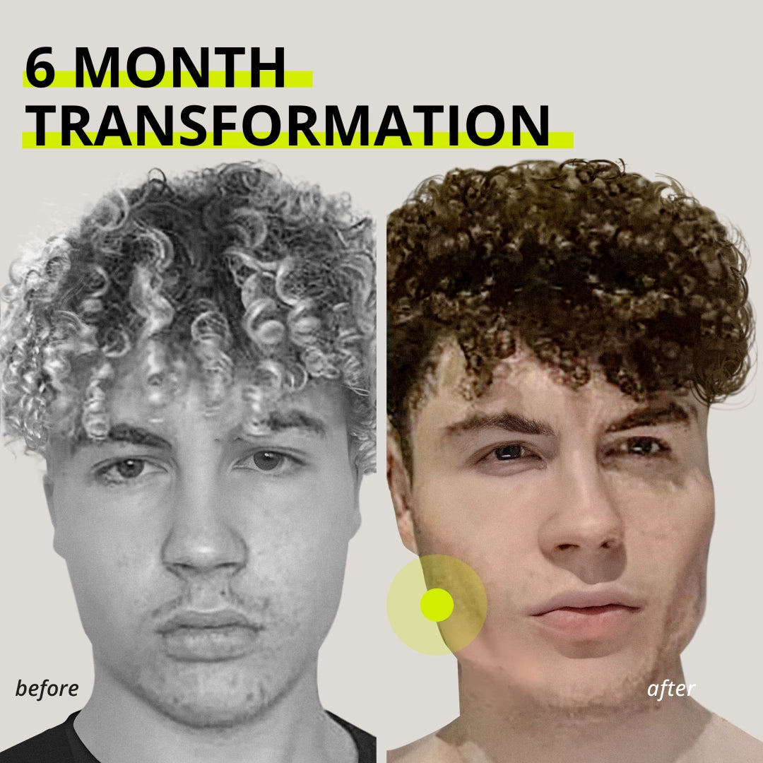 JAWLINER® 3.0 - Elite Edition - Beginner + Advanced