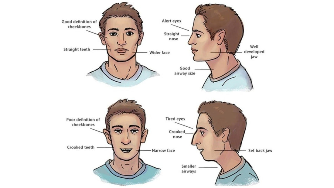 3 Effective Transformation: Mewing Before And After