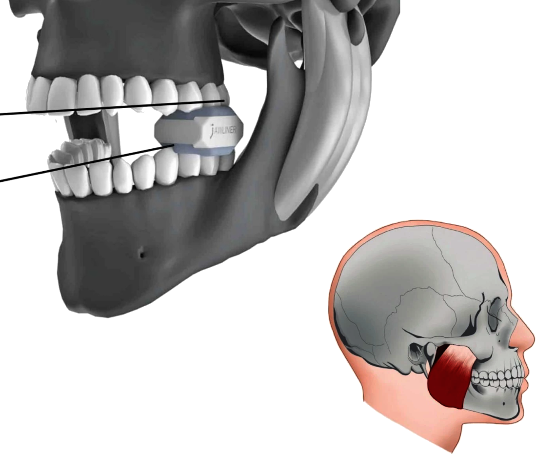 Mewing Instrument MEWING 101 – Jawliner USA