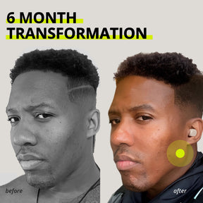 JAWLINER® Hard Chewing Gum | Watermelon | NEW DROP