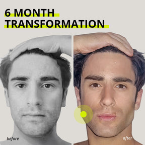 JAWLINER® Hard Chewing Gum | Watermelon | NEW DROP